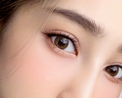 Tạo hình mí mắt nhẹ
