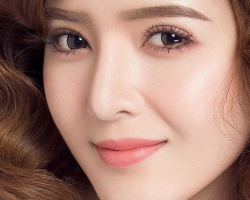Cắt da dư mí mắt