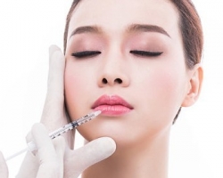 Tiêm Filler - Botox